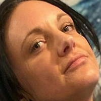 amputeedarling Nude