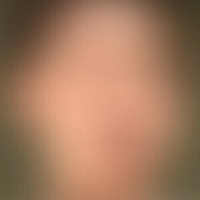 lucas-allen Nude