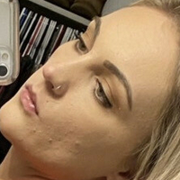 xoxalexis Nude